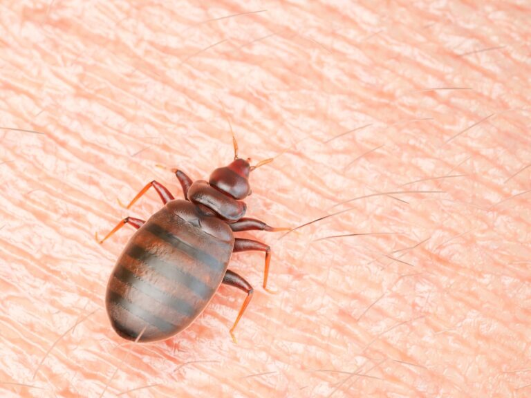 comment se debarrasser des araignees rampantes dans le dos