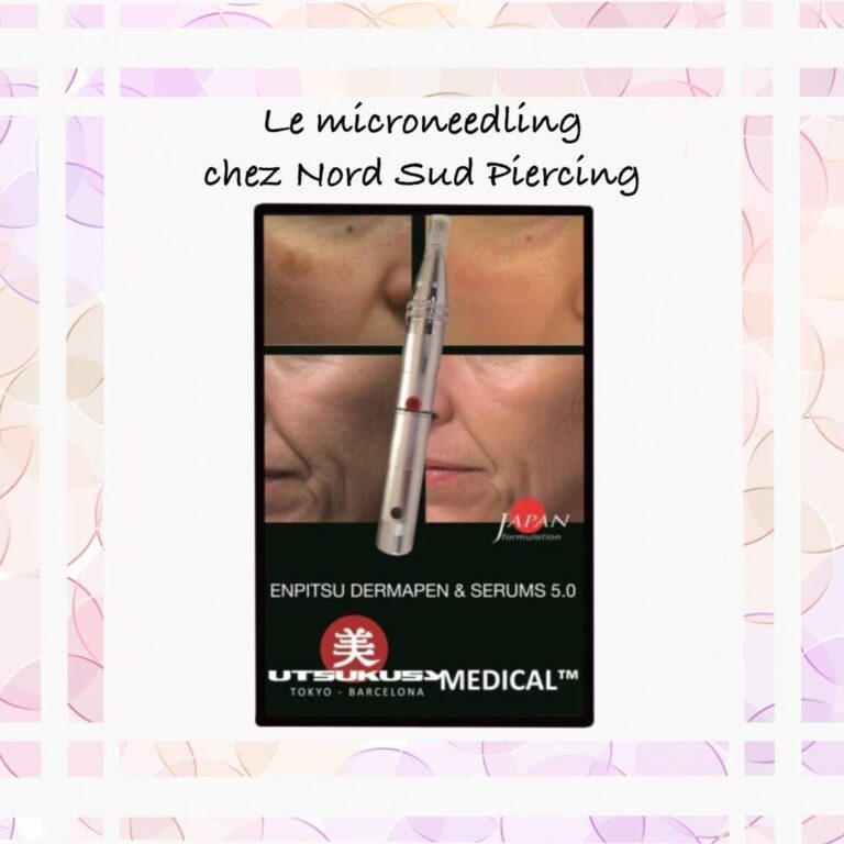 guide pratique pour eliminer les tatouds efficacement