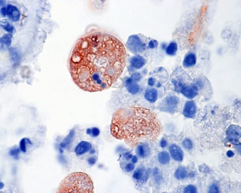 lutte antiparasitaire preparation efficace avec notre fiche pratique