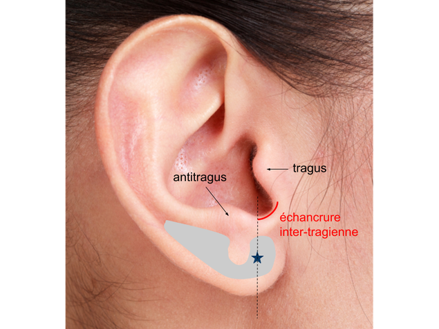 nuisibles les perceurs doreille et leur impact sur votre cerveau