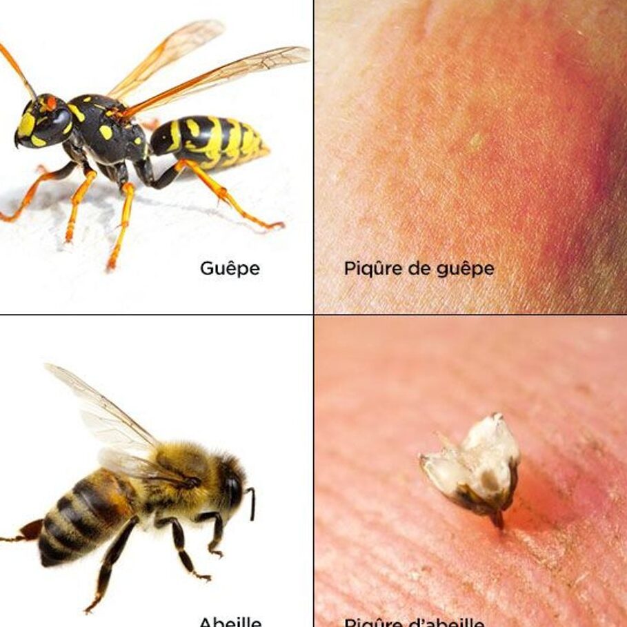 traitement-des-piqures-dabeilles-a-la-maison-remedes-efficaces-et-naturels